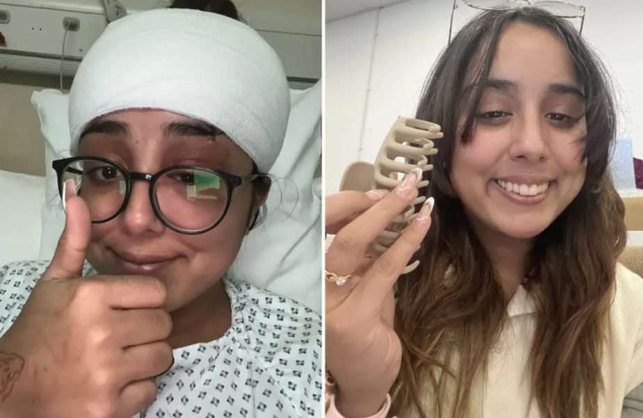 Doctor’s Warn Of The Danger Of Wearing Claw Clips Whilst Driving